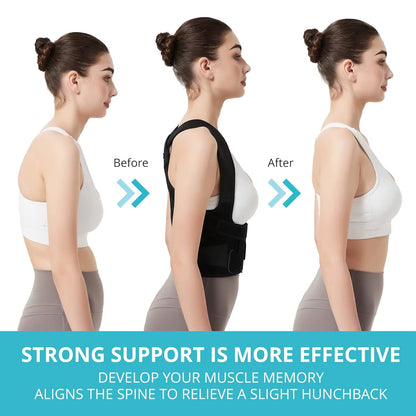 Back Brace Posture Support for Men and Women, Back Straightener Posture Support for Spinal Lateral Curve Concerns & Hunchback